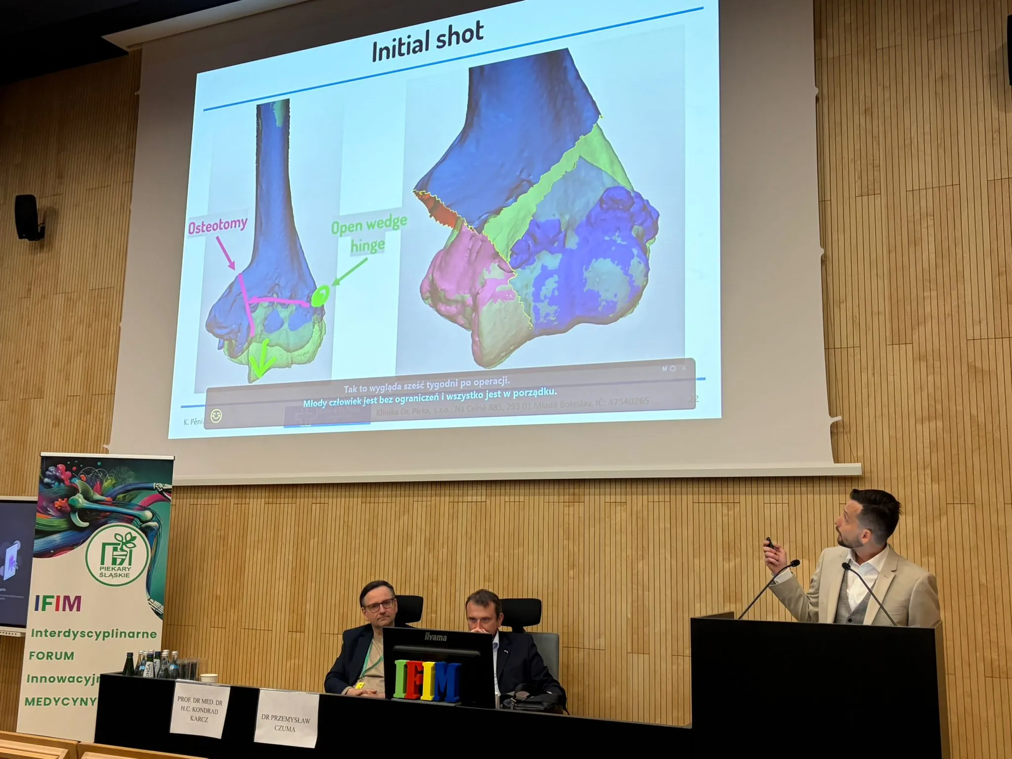 Planowanie przedoperacyjne 3D: osteotomia i klin otwarty